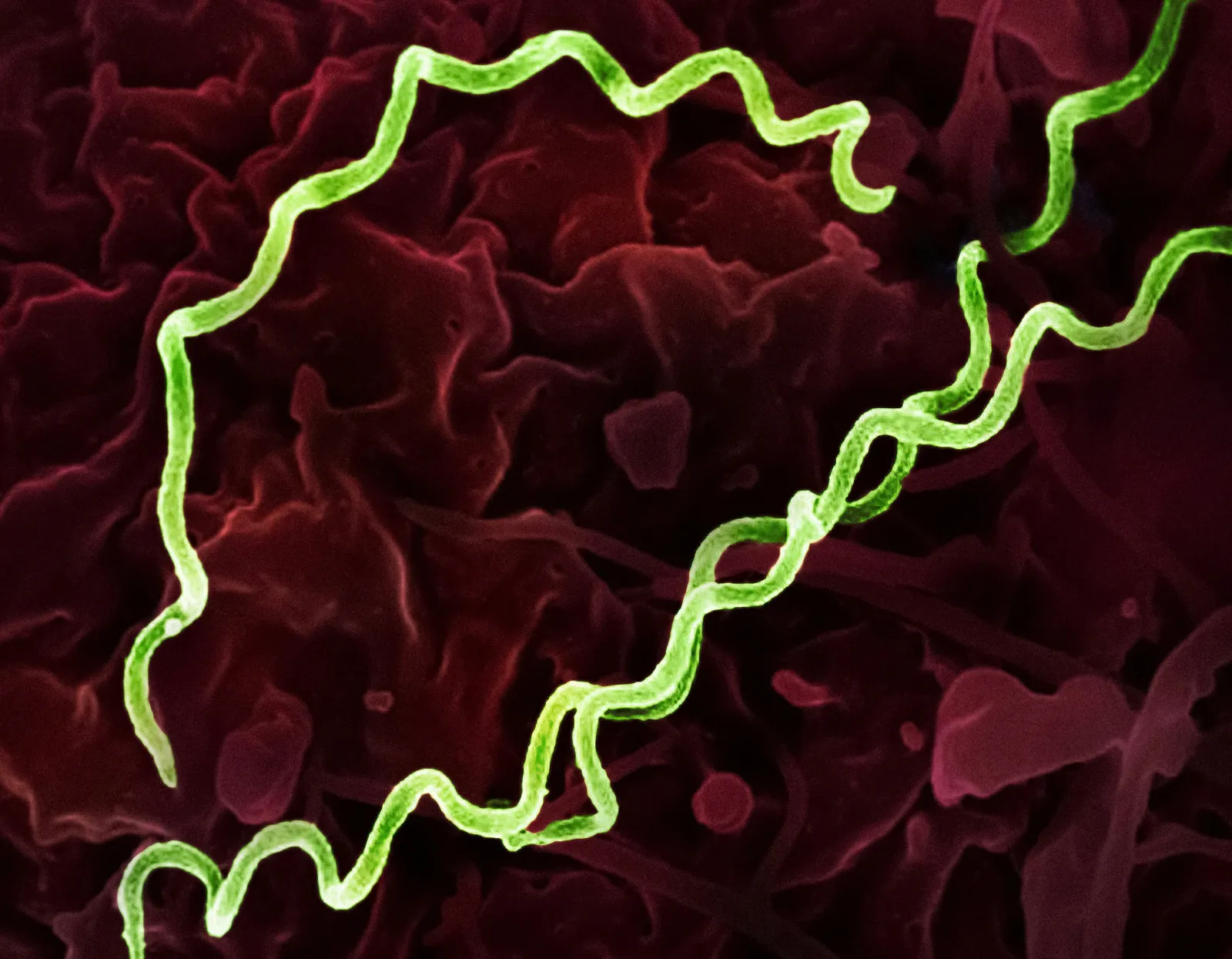 microbe telescopic view - how to study microbiology