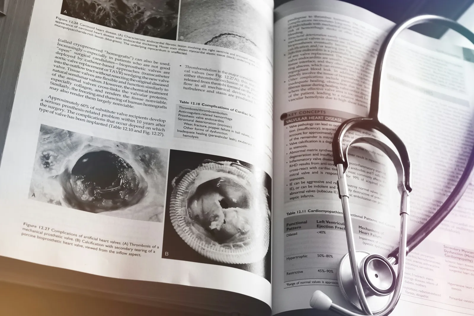 med student reading book - how to study physiology