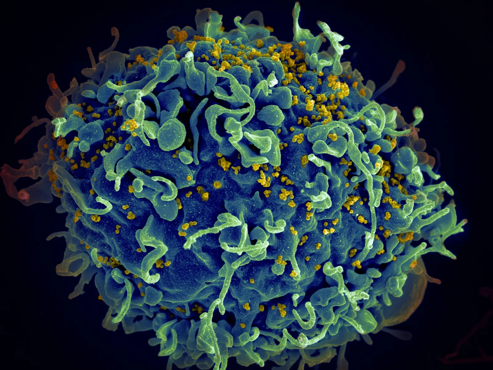 Complete Guide On How To Study Microbiology